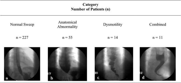 Barium swallow study cases technique