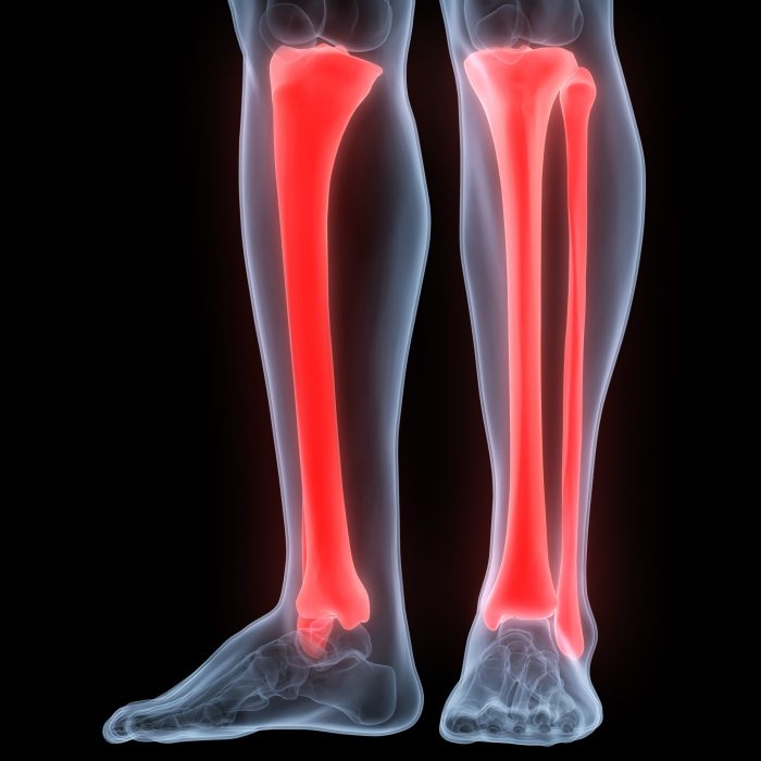 Fibula tibia posterior